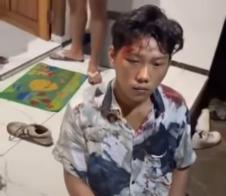 Kondisi korban yang dikeroyok orang tak dikenal di Pantai Wediawu, Malang