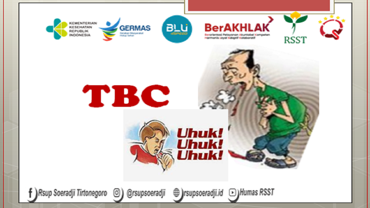 TBC